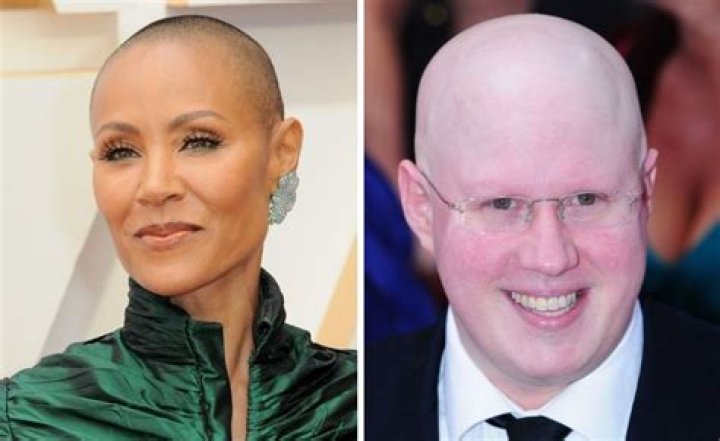 12 Celebrities With Alopecia & Hair Loss Wimpole Clinic