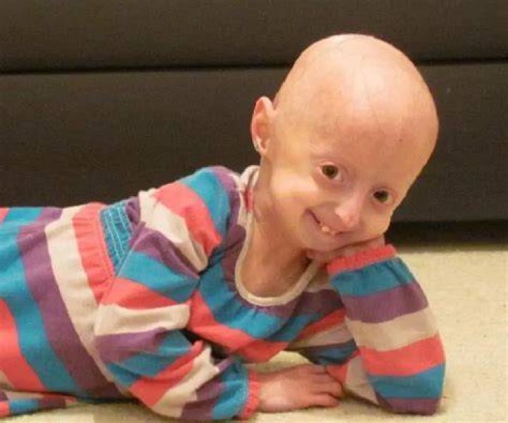 Adalia Rose Biography Facts, Childhood, Family Life & Achievements