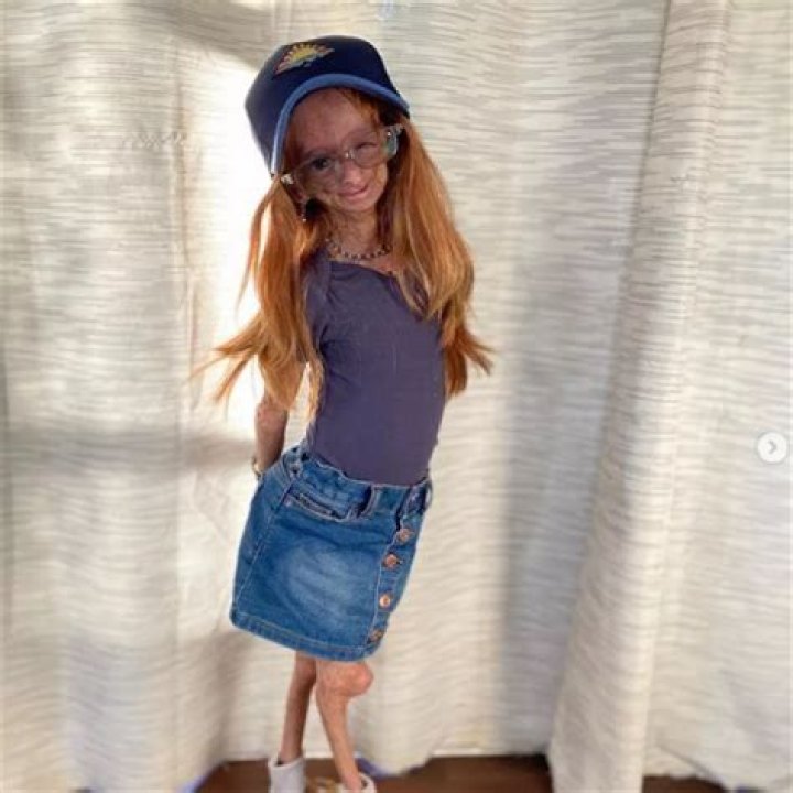 Adalia Rose: The Inspiring Journey Of A Young Social Media Star