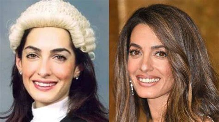 Amal Clooney Before Surgery: A Comprehensive Look At Her Journey