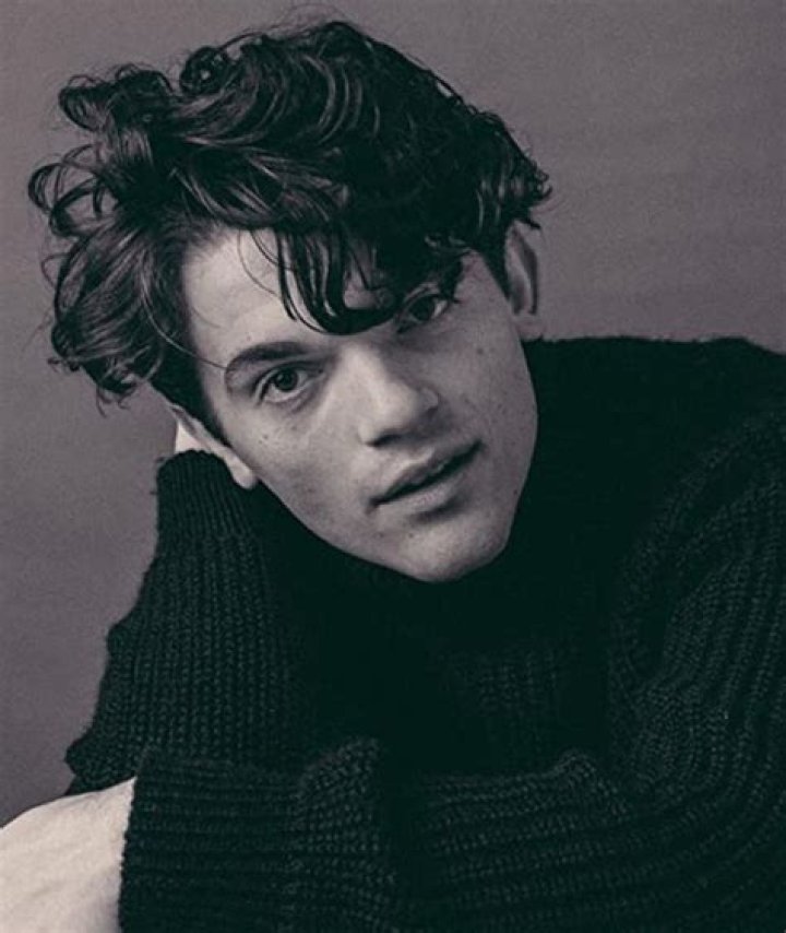 Edward Bluemel Medical Condition: Understanding His Unique Facial Features