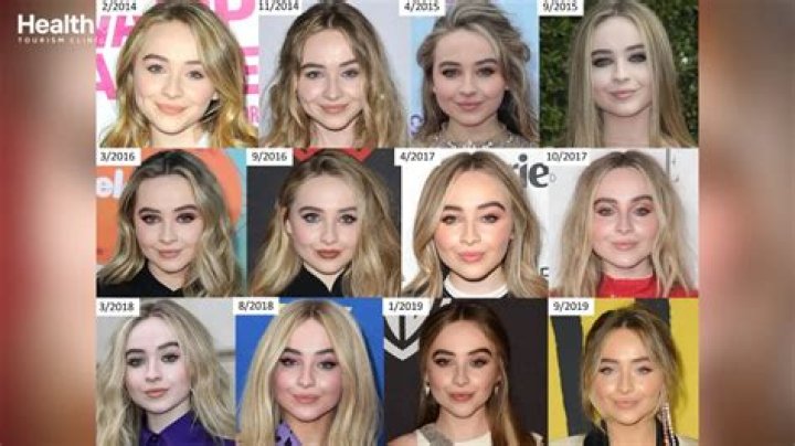 Everything You Need To Know About Sabrina Carpenter's Botox Journey