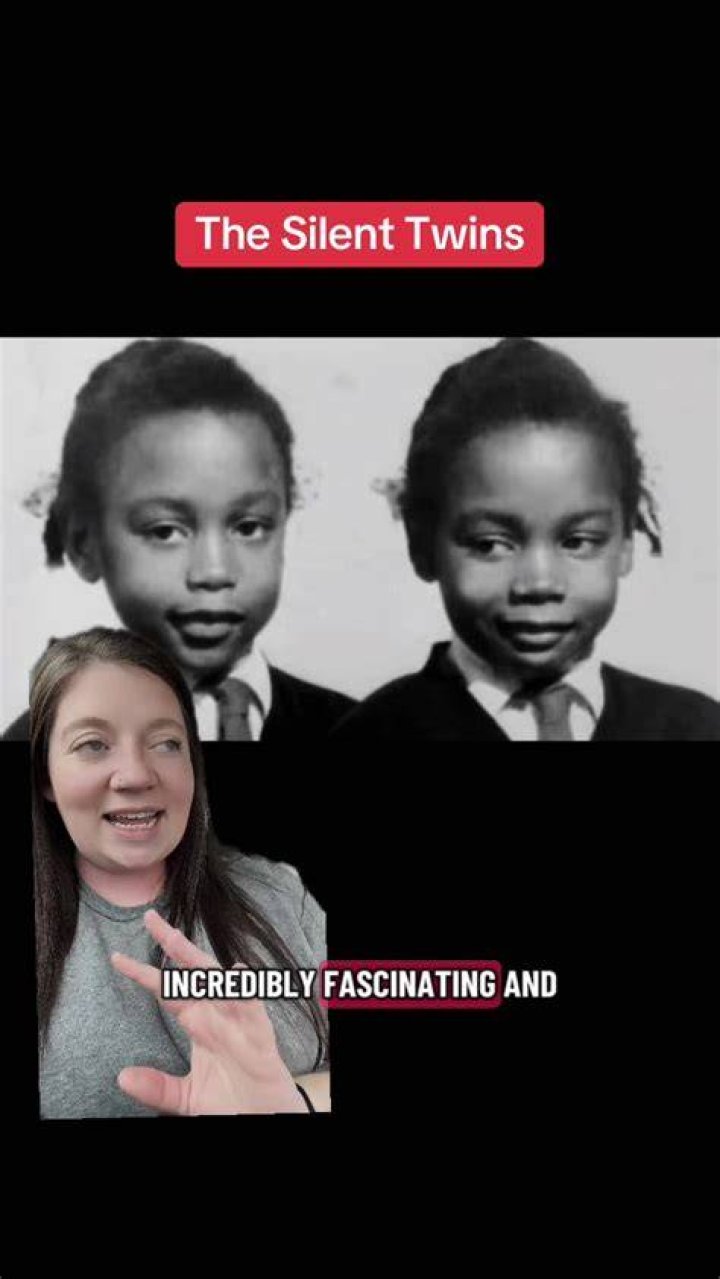Exploring The Fascinating World Of Shear Twins: Unraveling The Mystery