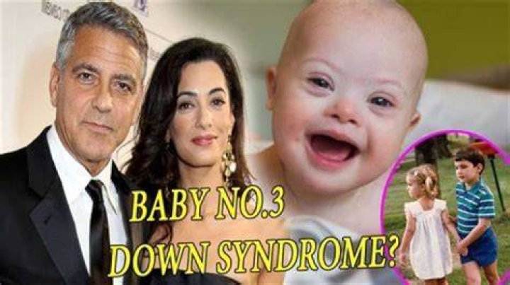 George Clooney's Sister: A Journey Through Down Syndrome