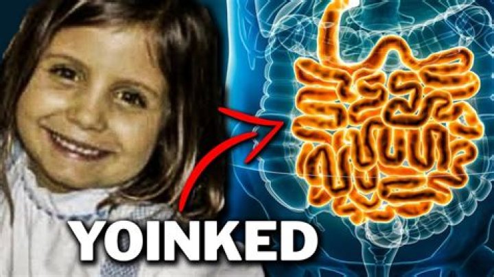 Girl whose intestines were ripped out by swimming pool&rsquo;s suction valve