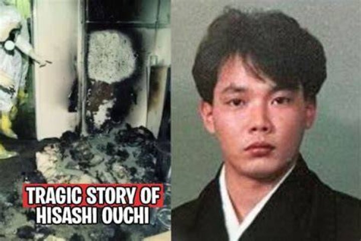 Hisashi Ouchi Full Photo: The Tragic Story Of A Nuclear Accident Victim