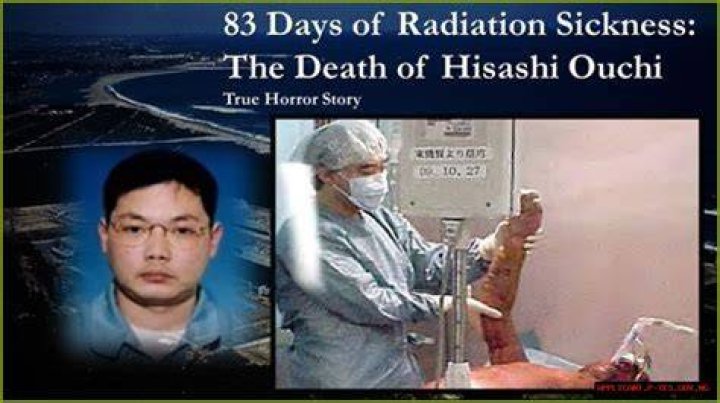 Hisashi Ouchi: The Real Photod And The Tragic Story Behind It