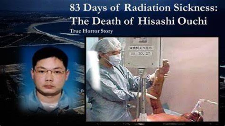 Hisashi Ouchi Video Real: The Tragic Story Behind The Infamous Incident