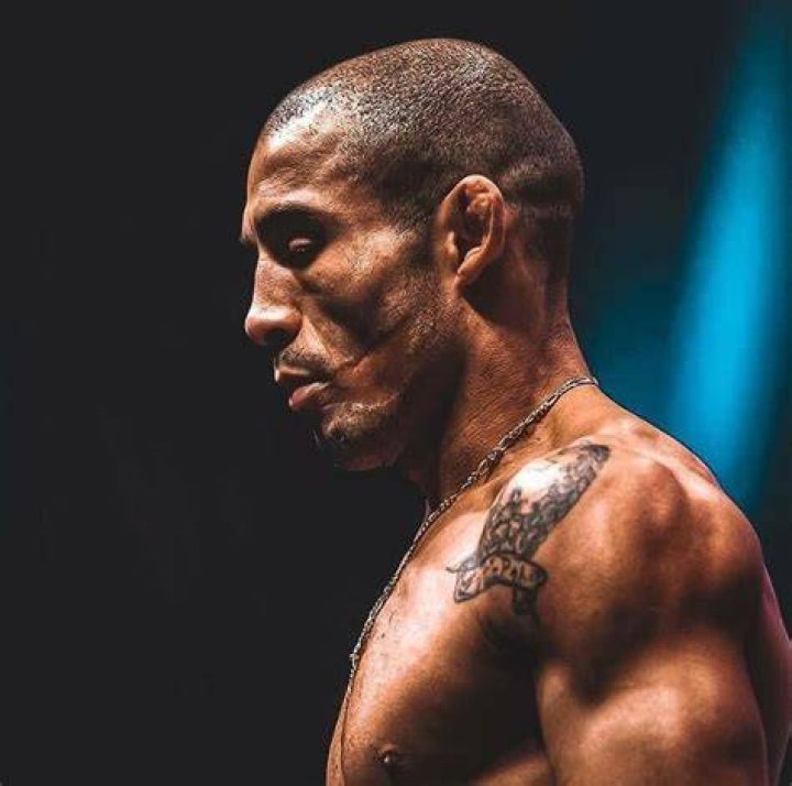 How Did Former UFC Champion Jose Aldo Get the Crazy Scar on His Face?