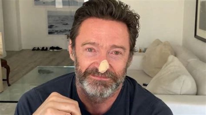 Hugh Jackman has new skin cancer scare, urges sun safety BBC News
