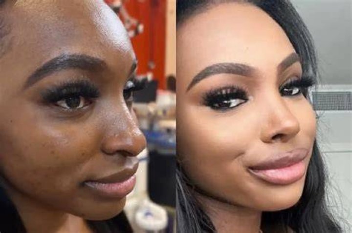 JaNa Love Island Nose Job Before Surgery Photos Exposed