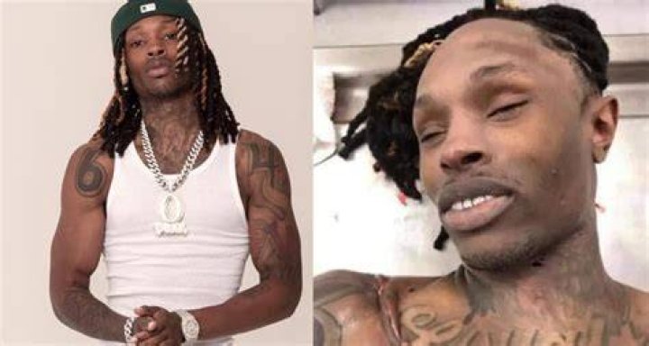 King Von Autopsy Leaked Photos Shake The Hip Hop World