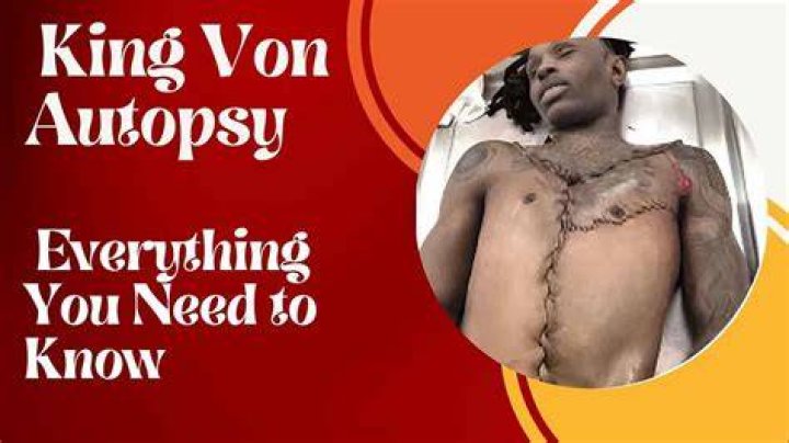 King Von Autopsy Released An InDepth Analysis Of The Circumstances
