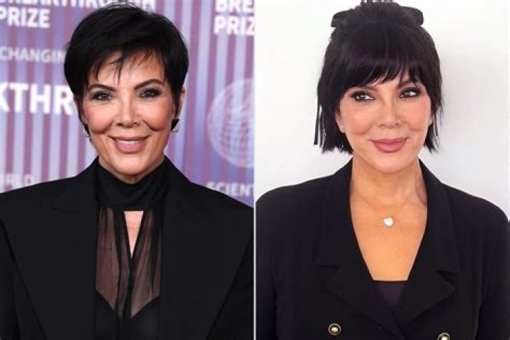 Kris Jenner's Sister Karen gets 5 Hour Facelift to Look Like Her! Watch