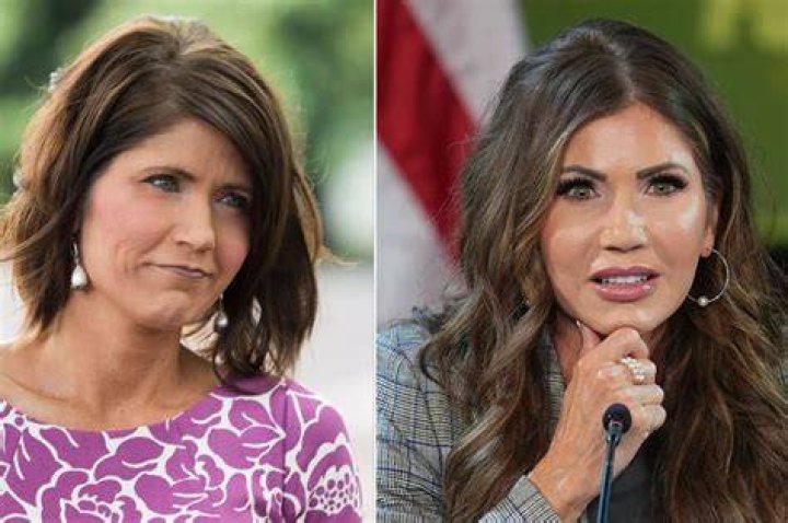 Kristi Noem Plastic Surgery Kristi Noem Stock Photos And Pictures