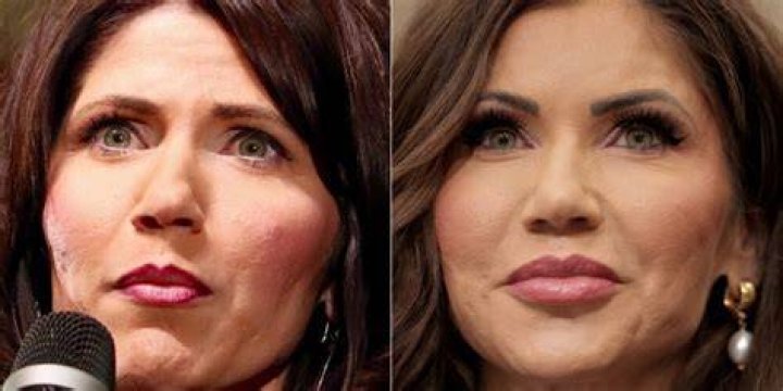 Kristi Noem Plastic Surgery: The Truth Behind The Transformation
