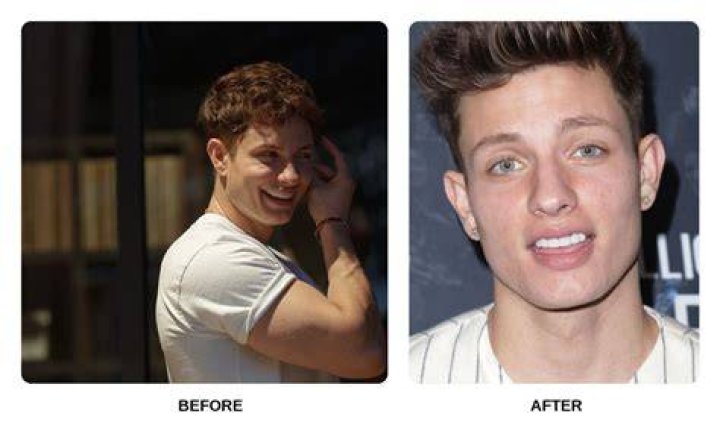 Matt Rife As A Teenager: Unlocking The Secrets Of Success