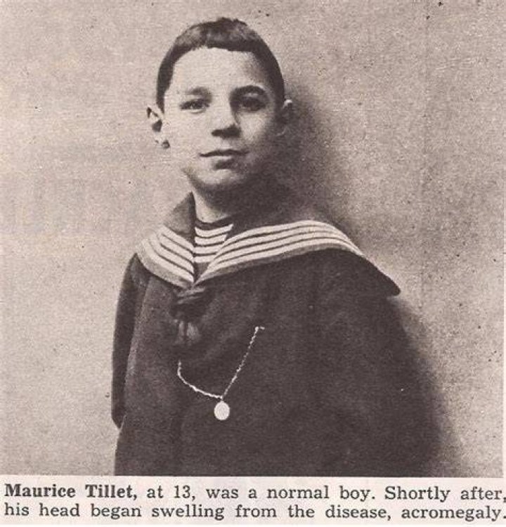Maurice Tillet Child