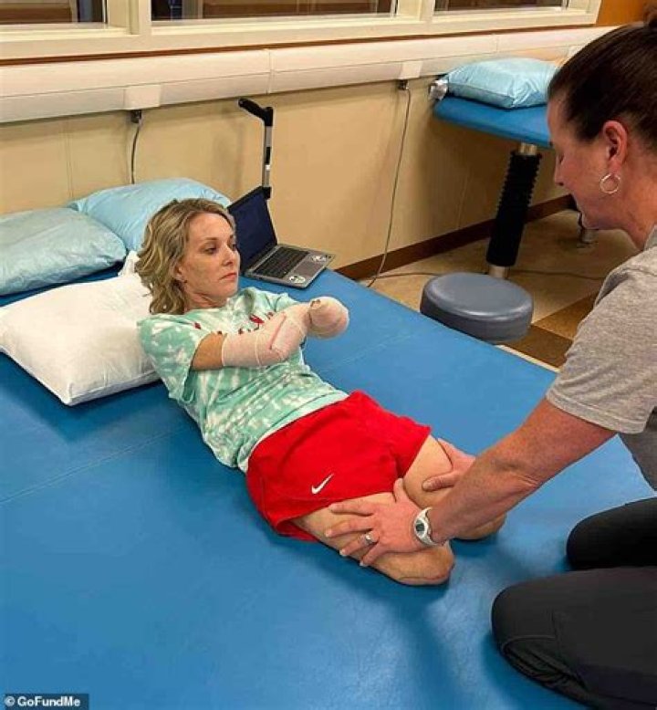 Mother loses all four limbs after routine kidney stone surgery