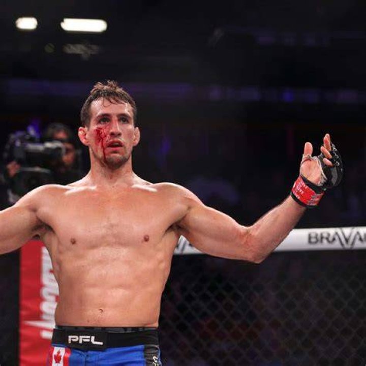 Rory Macdonald Looking Tired