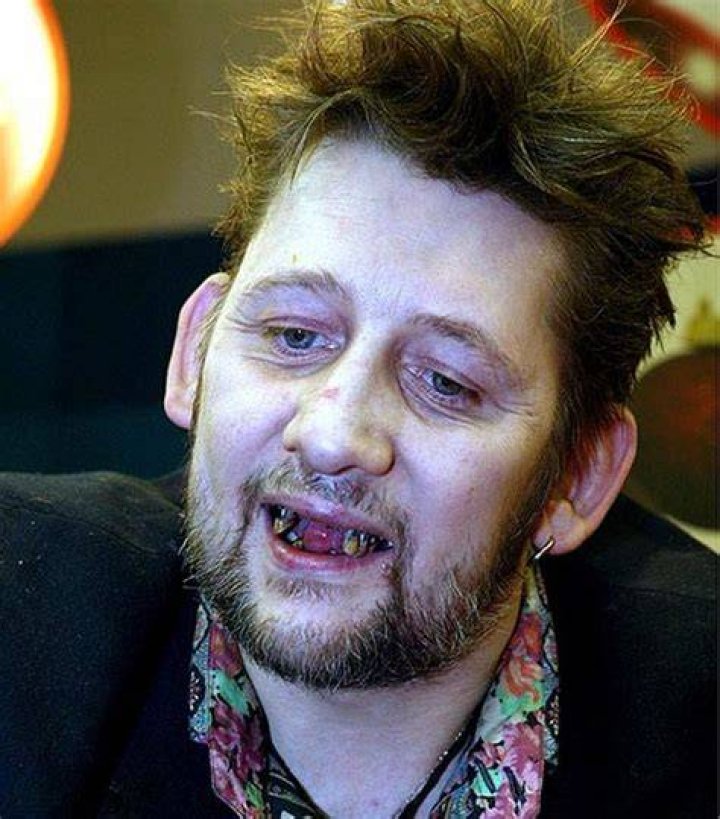 Shane MacGowan The Pogues frontman Shane MacGowan dies at 65