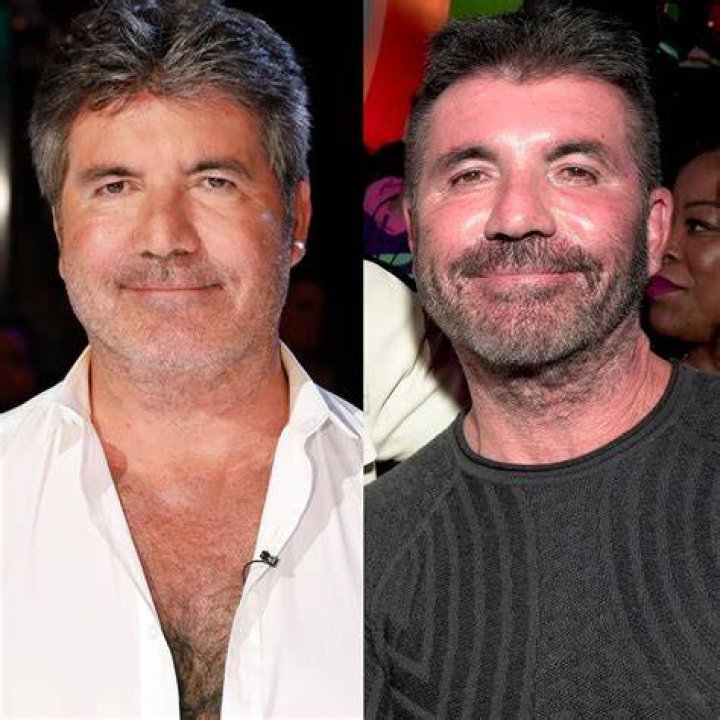 Simon Cowell Removes His Face Fillers After Saying He Went &ldquo;Too Far&rdquo;