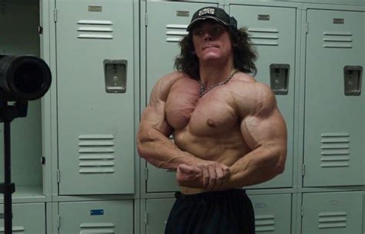 “Skin Looks Terrible From All the Roid Abuse.”: Despite Mindboggling Fame,
21-Y.O. Diver Turned Bodybuilder Allegedly on Gear Has the Fitness World Fuming
