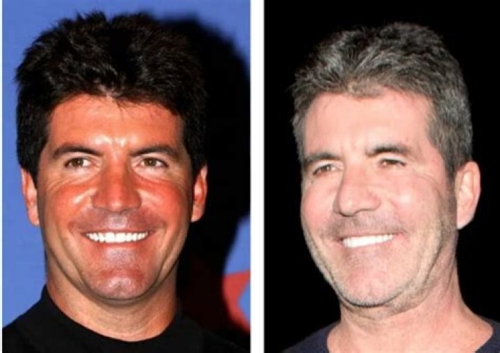Understanding Simon Cowell's Journey With His Disabled Son
