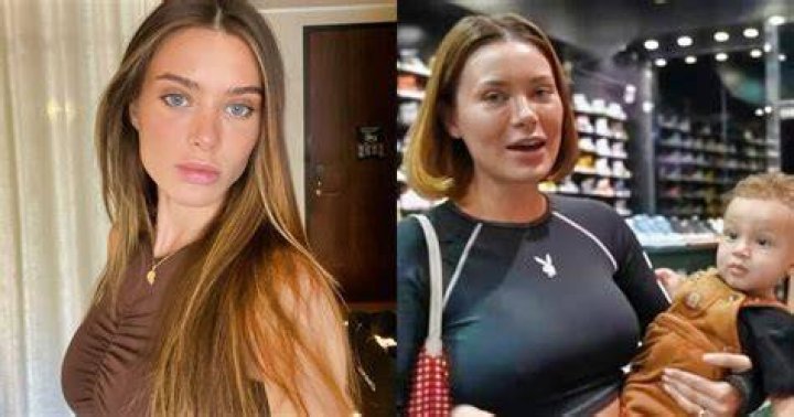 Vago deficiente sanidade lana rhoades face surgery Tornase em fun&ccedil;&atilde;o